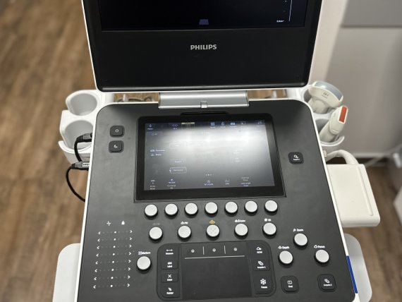 Nový ultrazvukový přístroj Philips 5500